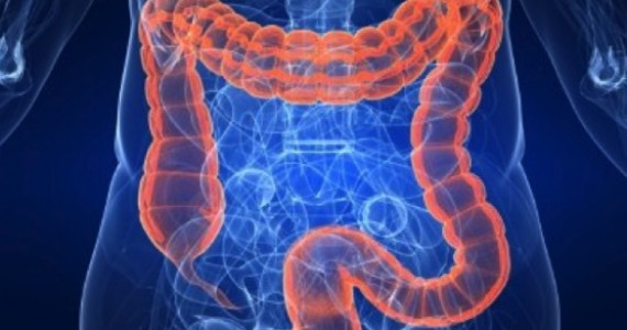 Sindromul de Intestin iritabil